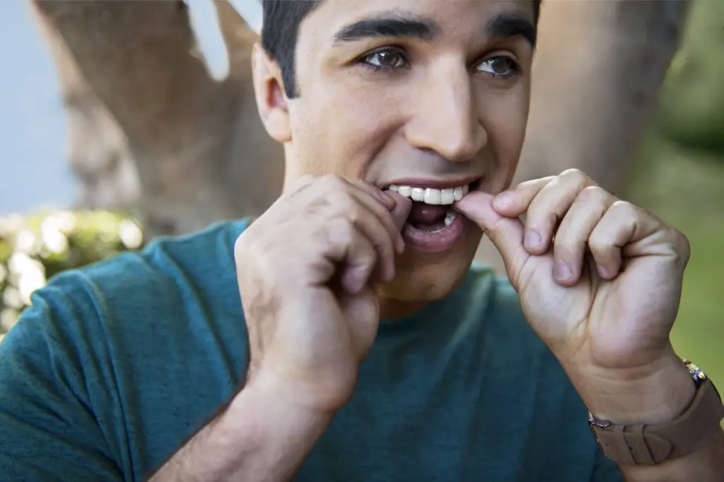 Invisalign Aligners