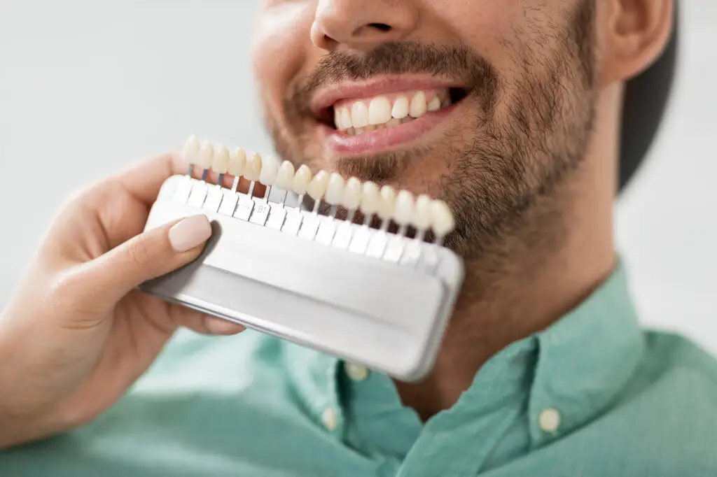 veneer procedure